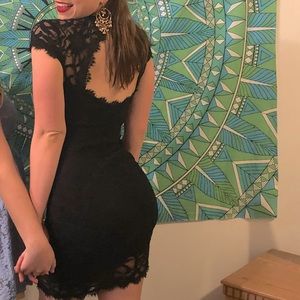 LBD - Little (Lacy) Black (Back-details) Dress ❤️